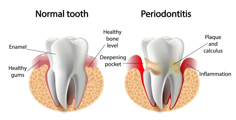 Periodontics